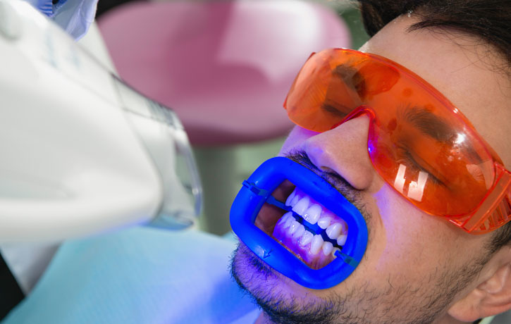 Teeth Whitening Douglasville, GA